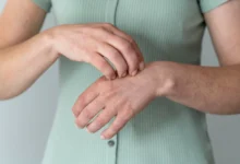Psoriatic Arthritis