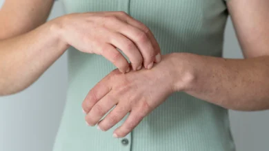 Psoriatic Arthritis